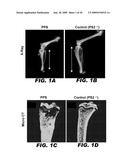 USE OF NOTCH SIGNALING REGULATORS FOR MODULATING OSTEOGENESIS diagram and image