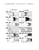 USE OF NOTCH SIGNALING REGULATORS FOR MODULATING OSTEOGENESIS diagram and image