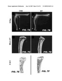 USE OF NOTCH SIGNALING REGULATORS FOR MODULATING OSTEOGENESIS diagram and image