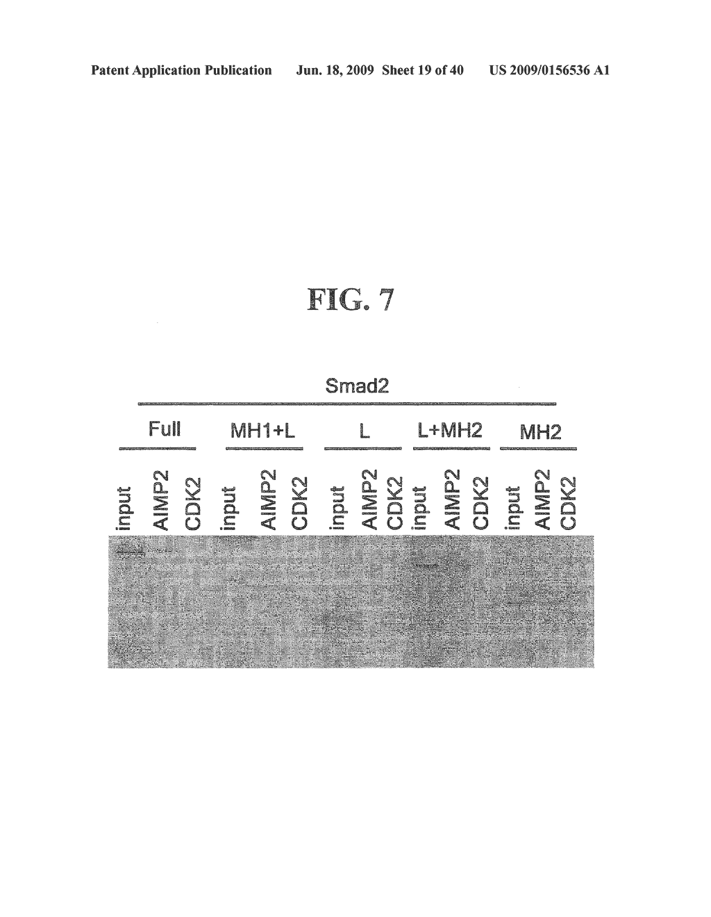 AIMP2-DX2 Gene and SiRNA Targeting AIMP2-DX2 - diagram, schematic, and image 20