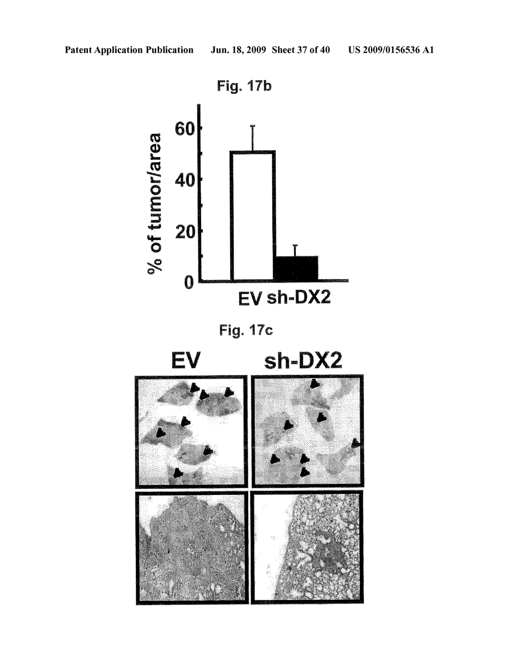 AIMP2-DX2 Gene and SiRNA Targeting AIMP2-DX2 - diagram, schematic, and image 38