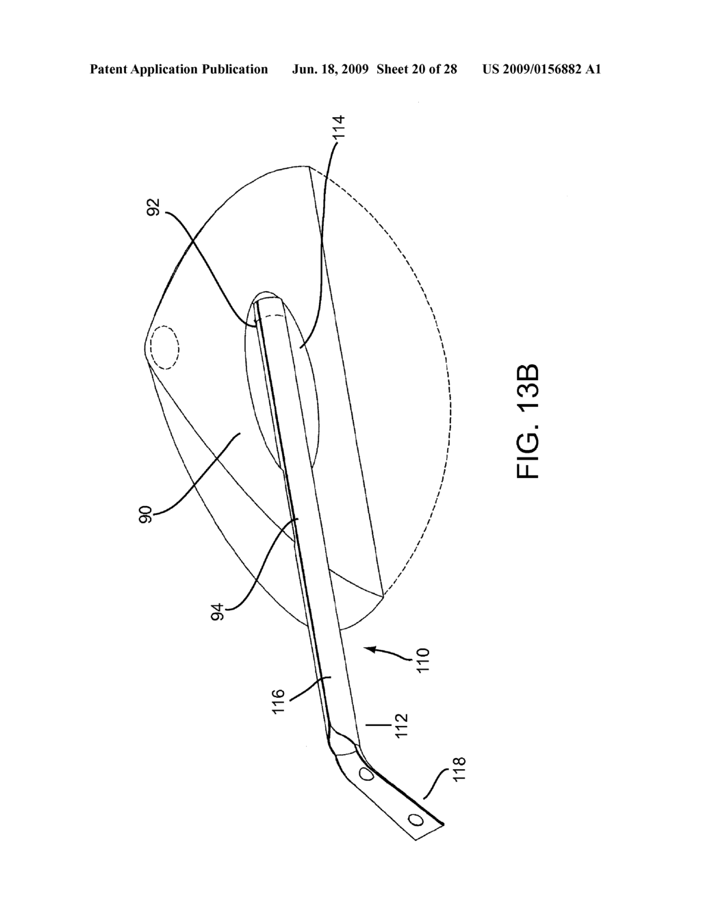 EXPANDABLE BRACHYTHERAPY APPARATUS AND METHODS FOR USING THEM - diagram, schematic, and image 21