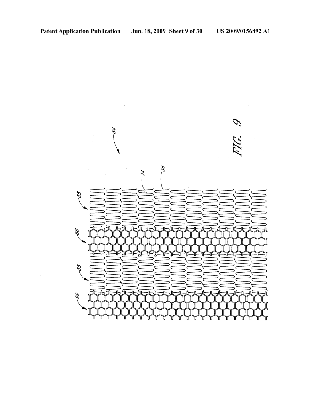 CARDIAC HARNESS - diagram, schematic, and image 10