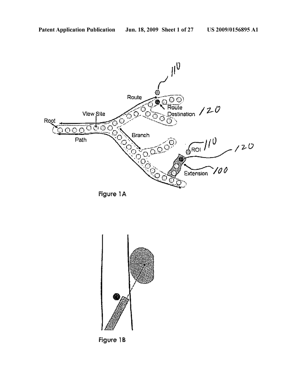 PRECISE ENDOSCOPIC PLANNING AND VISUALIZATION - diagram, schematic, and image 02