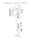 ARTICULATING HOOK ELEVATOR AND ARTHROSCOPIC METHOD FOR USING SAME diagram and image