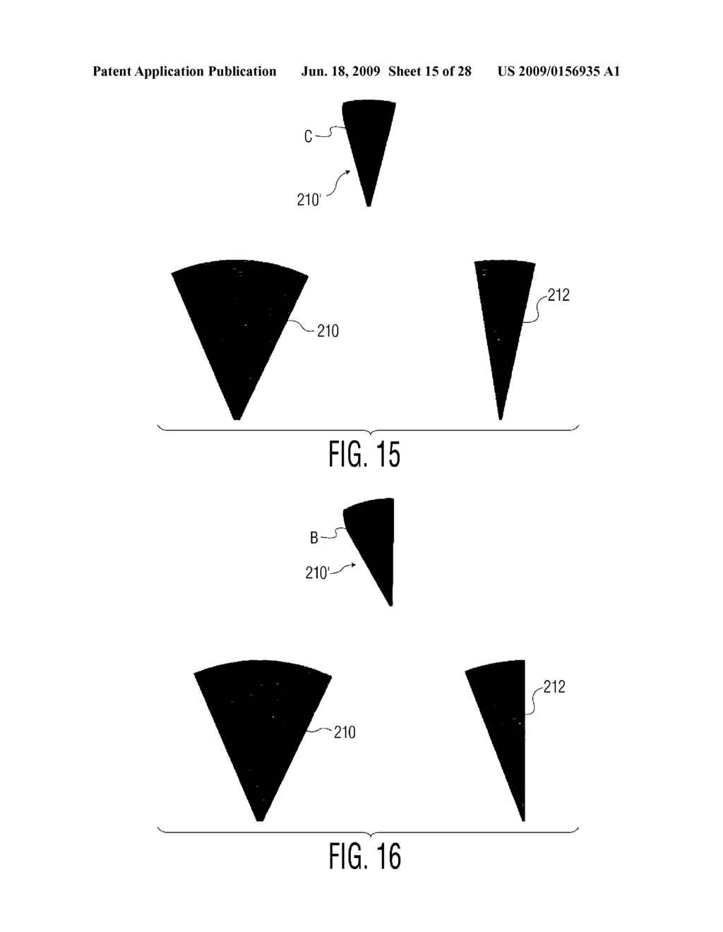 Three Dimensional Diagnostic Ultrasound Imaging System with Image Reversal and Inversion - diagram, schematic, and image 16