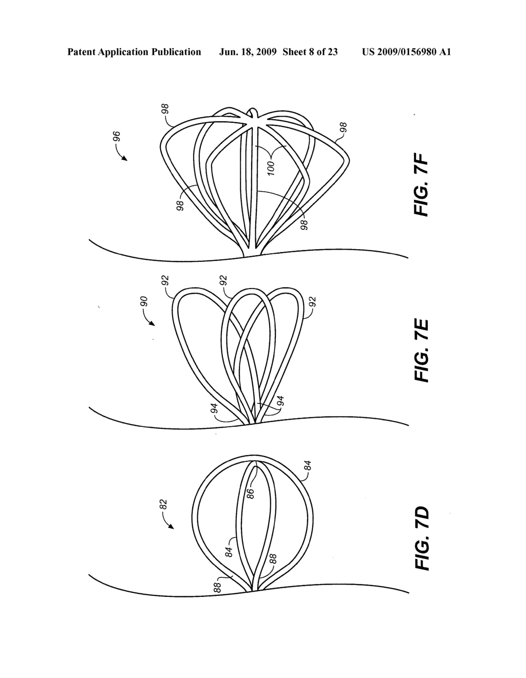 DEVICE AND METHODS FOR TREATING PARANASAL SINUS CONDITIONS - diagram, schematic, and image 09