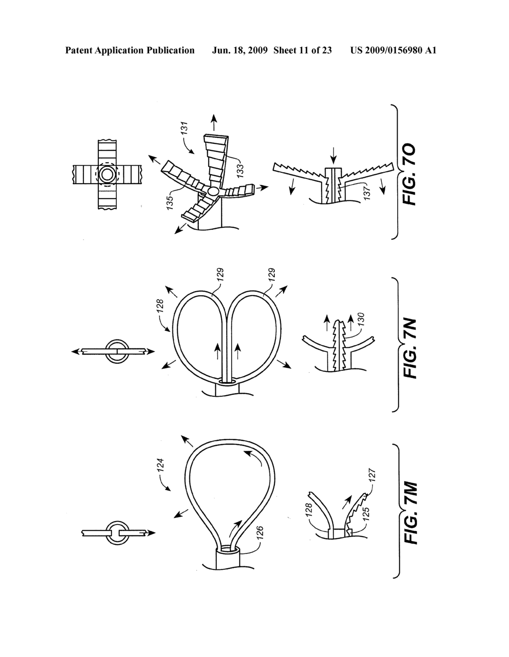 DEVICE AND METHODS FOR TREATING PARANASAL SINUS CONDITIONS - diagram, schematic, and image 12