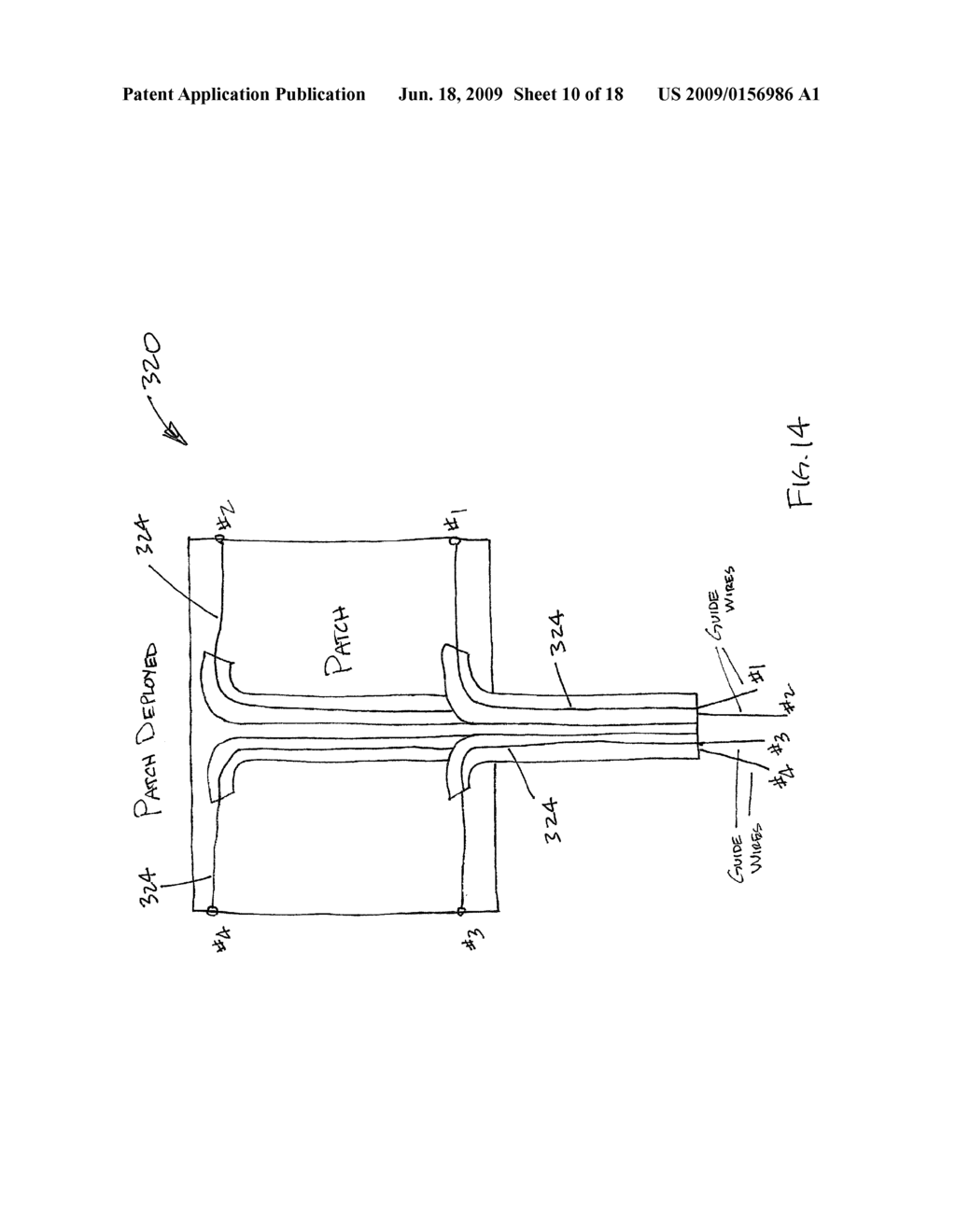 ROTATOR CUFF PATCH DELIVERY DEVICE - diagram, schematic, and image 11