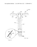 ROTATOR CUFF PATCH DELIVERY DEVICE diagram and image