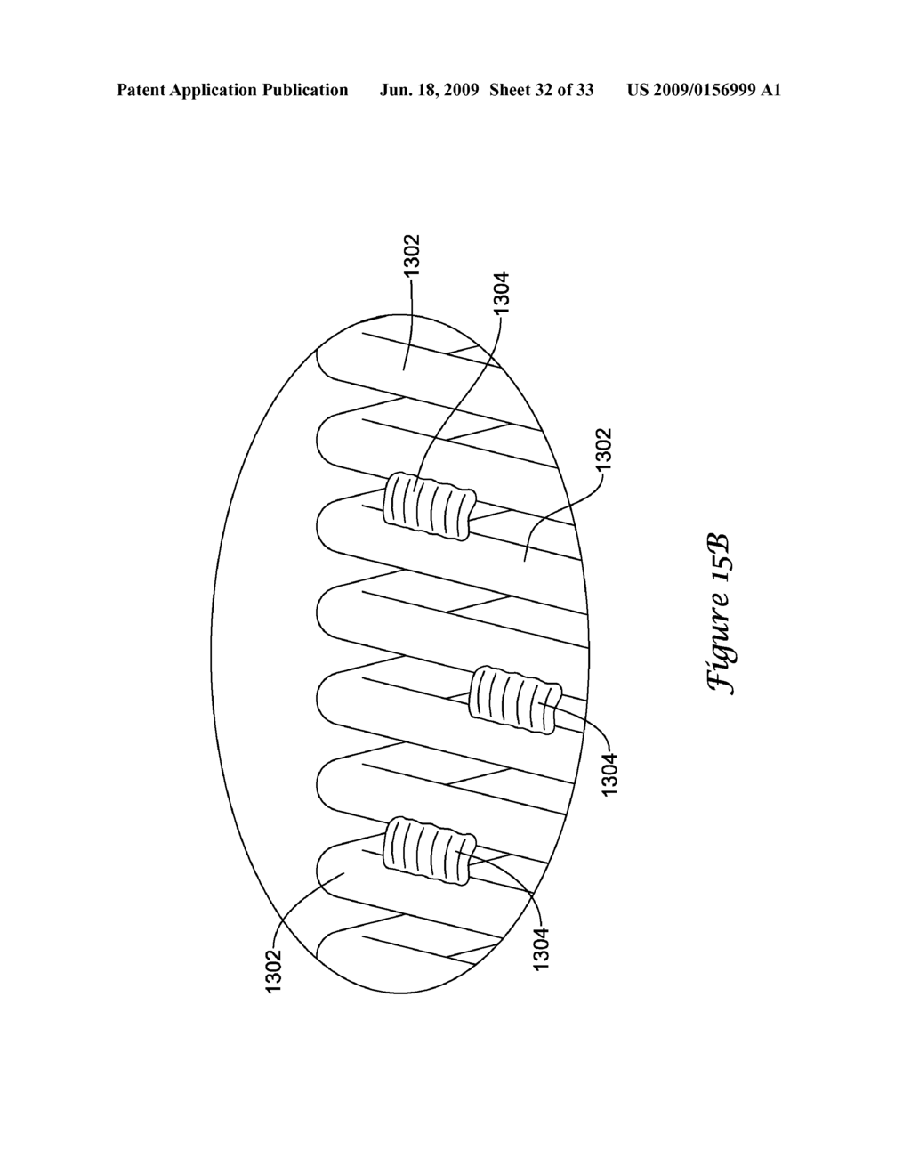 COIL MEMBER FOR A MEDICAL DEVICE - diagram, schematic, and image 33