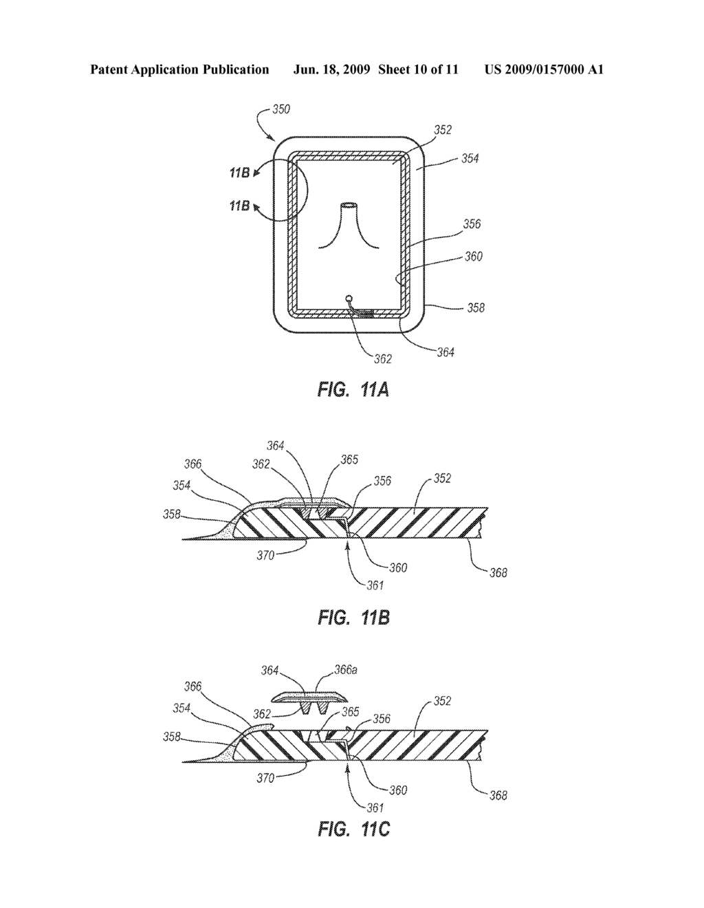 BARRIER SYSTEM TO REDUCE THE RATES OF LINE-RELATED INFECTIONS - diagram, schematic, and image 11