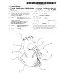 METHODS, DEVICES AND COMPOSITIONS FOR CONTROLLED DRUG DELIVERY TO INJURED MYOCARDIUM diagram and image