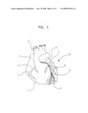 METHODS, DEVICES AND COMPOSITIONS FOR CONTROLLED DRUG DELIVERY TO INJURED MYOCARDIUM diagram and image