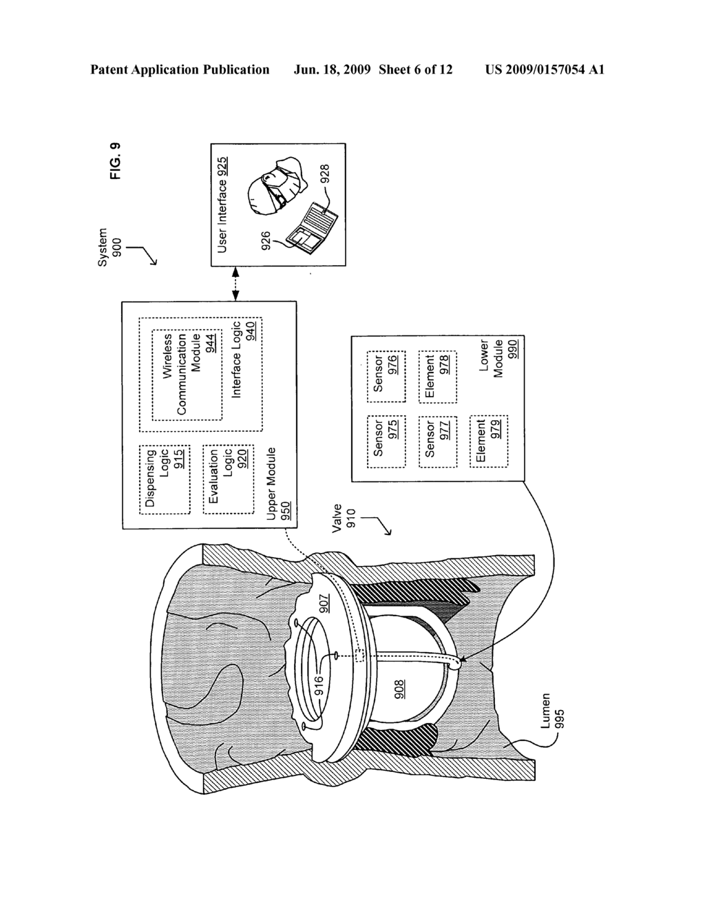 Treatment indications informed by a priori implant information - diagram, schematic, and image 07