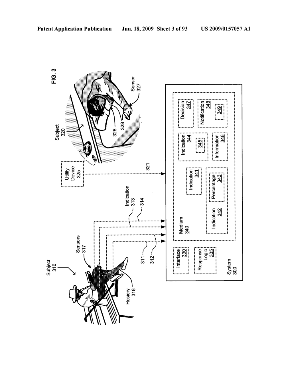 Circulatory monitoring systems and methods - diagram, schematic, and image 04