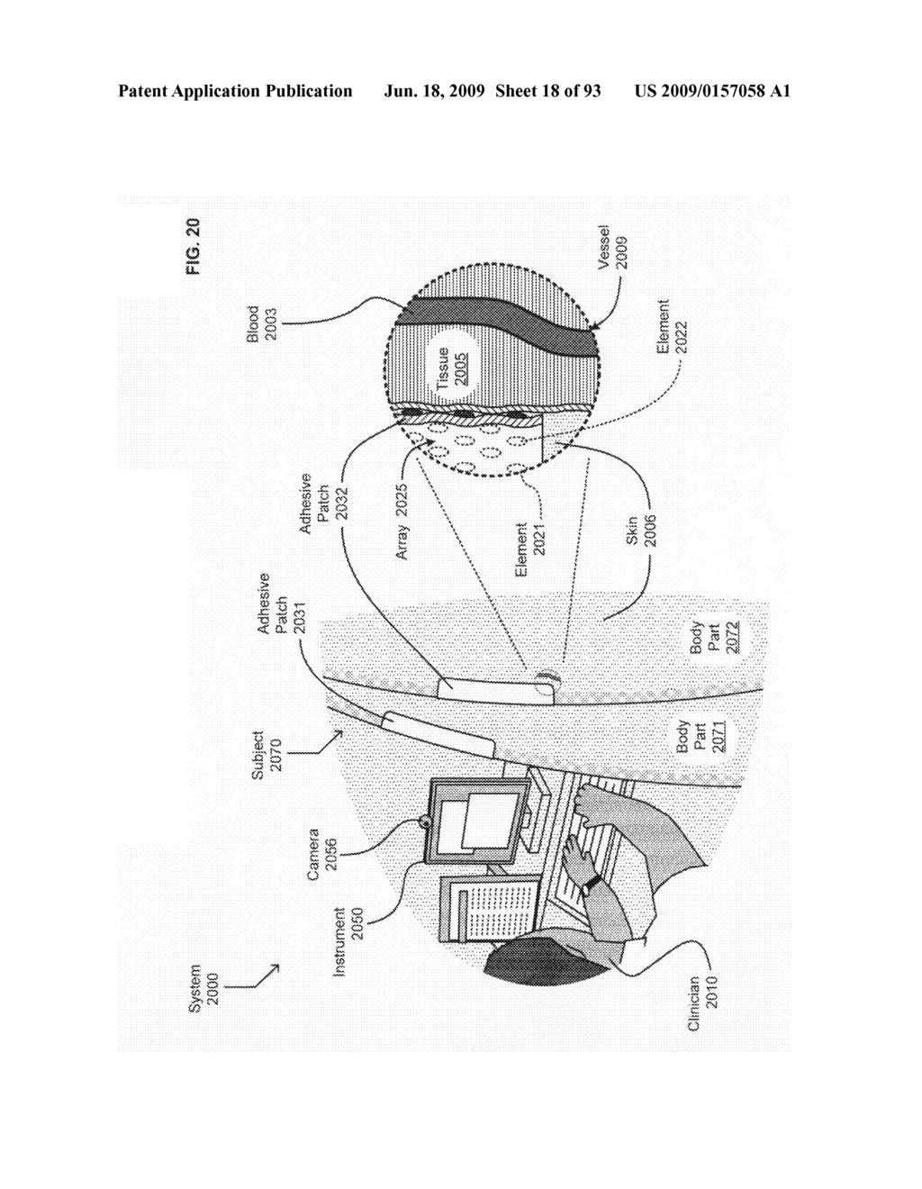 Circulatory monitoring systems and methods - diagram, schematic, and image 19