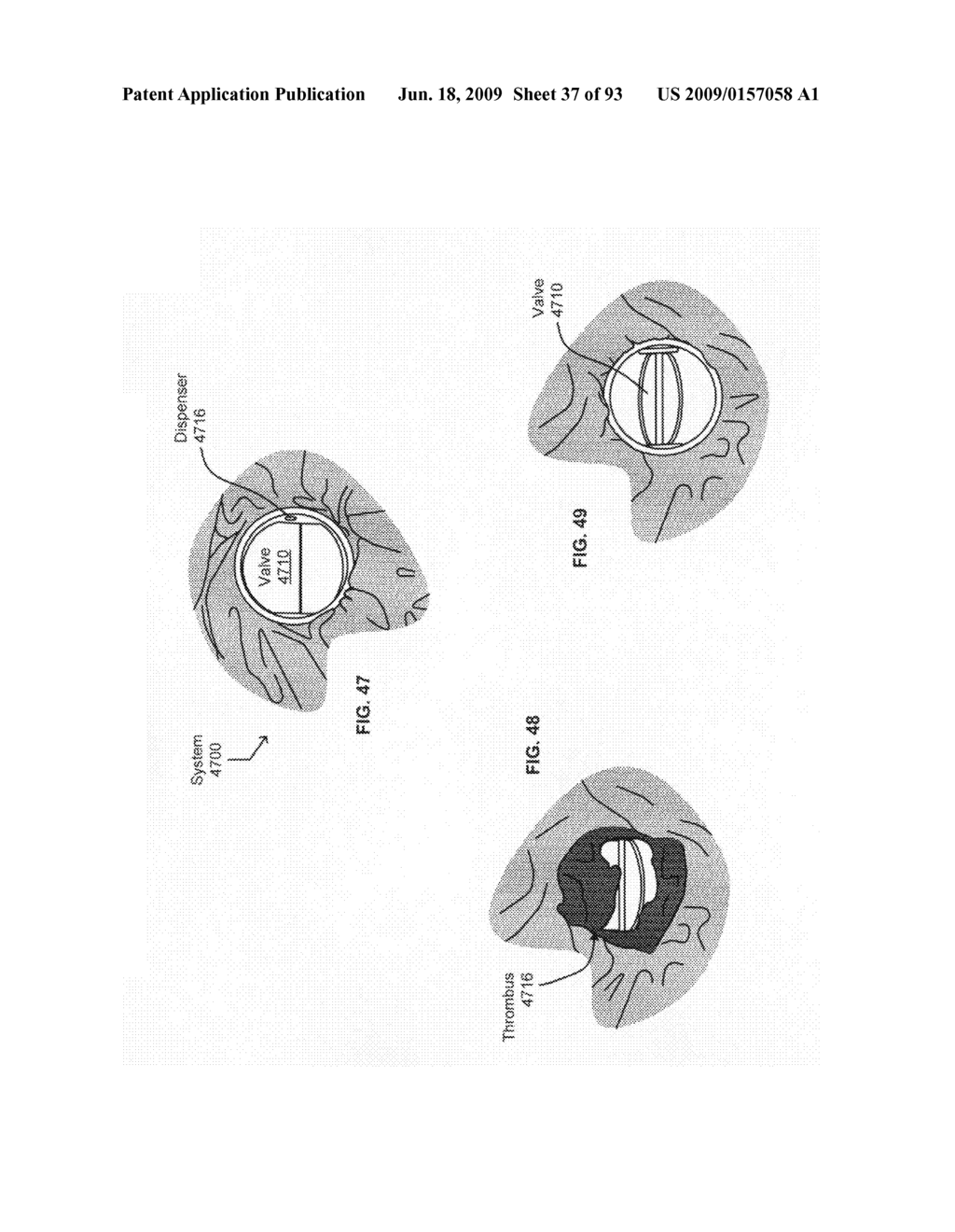 Circulatory monitoring systems and methods - diagram, schematic, and image 38