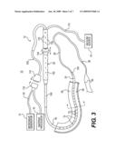 INTRAOPERATIVE ELECTRICAL CONDUCTION MAPPING SYSTEM diagram and image