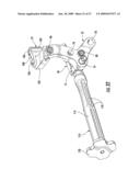 GUIDE ASSEMBLY FOR INTRAMEDULLARY FIXATION AND METHOD OF USING THE SAME diagram and image