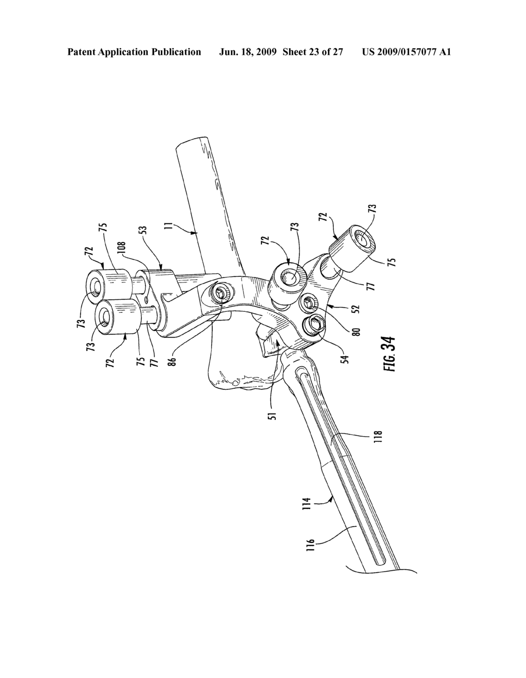 GUIDE ASSEMBLY FOR INTRAMEDULLARY FIXATION AND METHOD OF USING THE SAME - diagram, schematic, and image 24