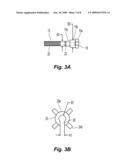 Apparatus and Methods of Repairing Bone Defects diagram and image