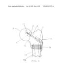 Apparatus and Methods of Repairing Bone Defects diagram and image