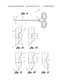 DEVICE AND METHOD FOR INTRODUCING A BONE CEMENT MIXTURE INTO A DAMAGED BONE diagram and image