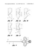 DEVICE AND METHOD FOR INTRODUCING A BONE CEMENT MIXTURE INTO A DAMAGED BONE diagram and image