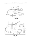 DEVICE AND METHOD FOR INTRODUCING A BONE CEMENT MIXTURE INTO A DAMAGED BONE diagram and image