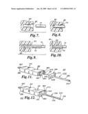 Apparatus for Implanting Neural Stimulation Leads diagram and image