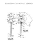 Apparatus for Implanting Neural Stimulation Leads diagram and image