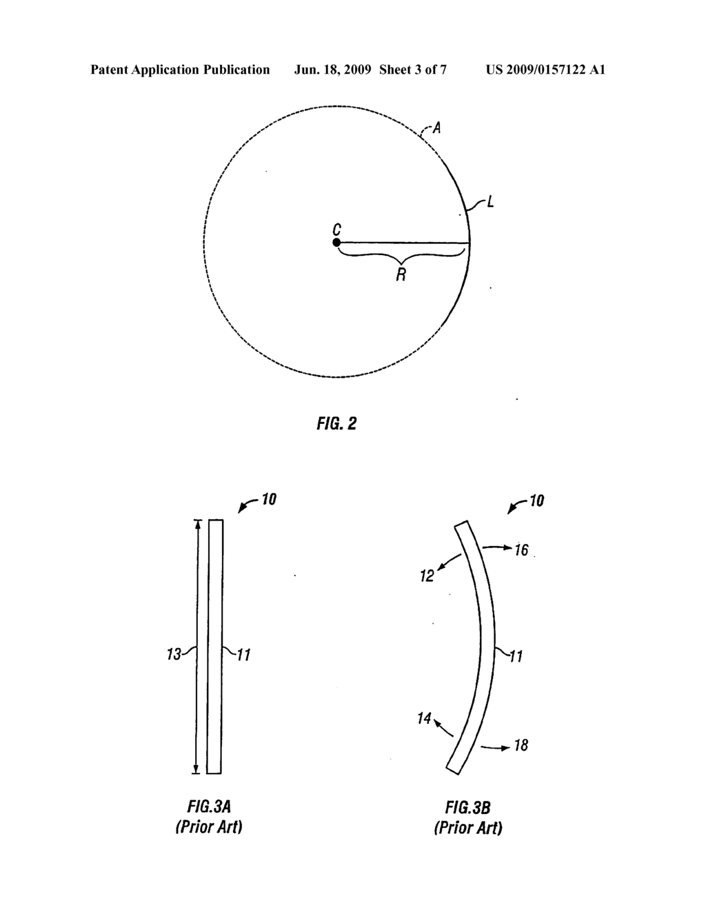 BONE COMPRESSION DEVICE - diagram, schematic, and image 04