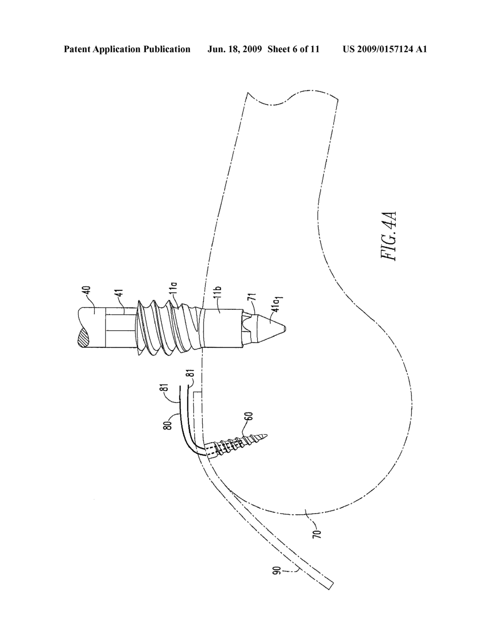 Anchoring System - diagram, schematic, and image 07