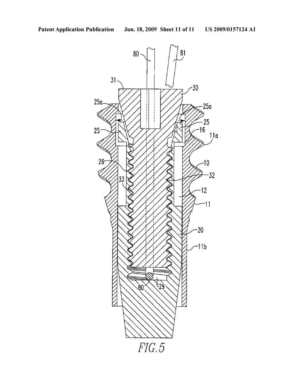 Anchoring System - diagram, schematic, and image 12