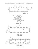 Degradable Endoprosthesis diagram and image