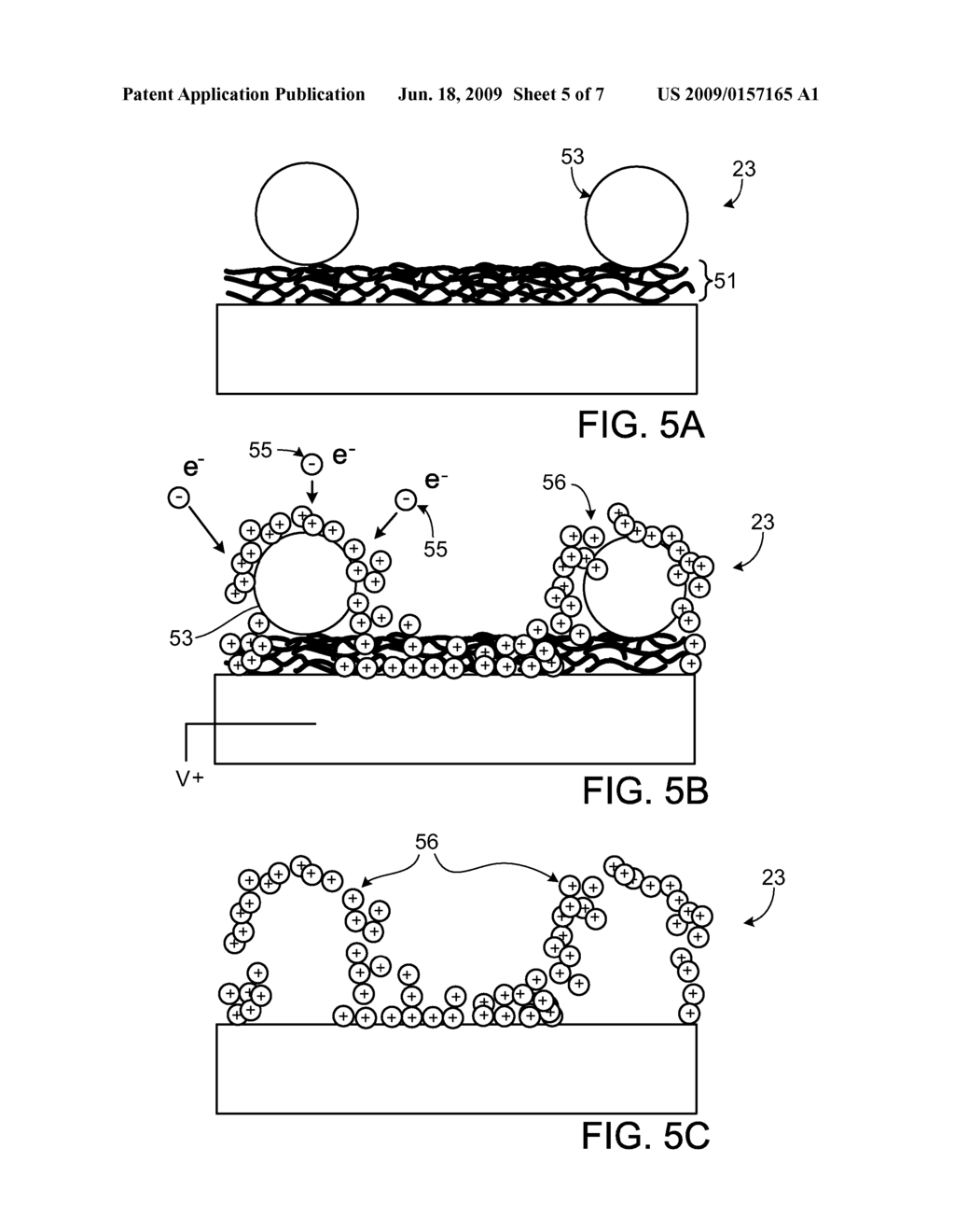 Degradable Endoprosthesis - diagram, schematic, and image 06