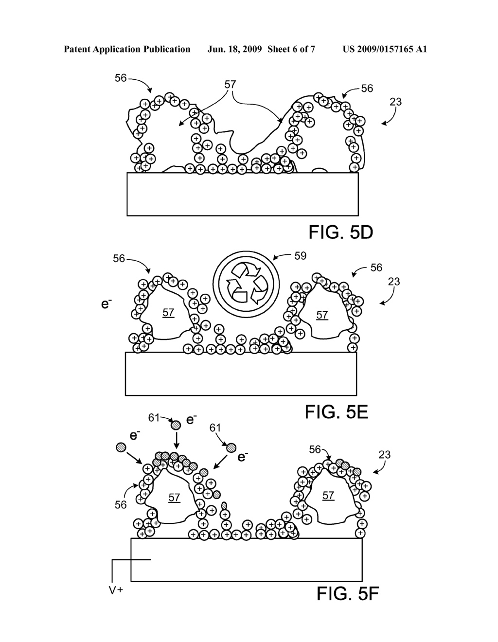 Degradable Endoprosthesis - diagram, schematic, and image 07