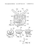 LEAFLET ATTACHMENT FRAME FOR A PROSTHETIC VALVE diagram and image