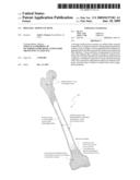 Biologic Artificial Bone diagram and image