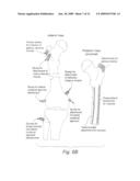 Biologic Artificial Bone diagram and image