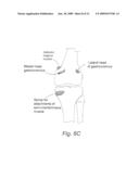 Biologic Artificial Bone diagram and image