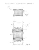 Biologic Artificial Bone diagram and image