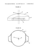 Intervertebral Disc Prosthesis diagram and image