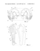 Modular Articulating Cement Spacer Mold diagram and image