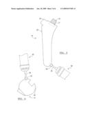 Modular Articulating Cement Spacer Mold diagram and image