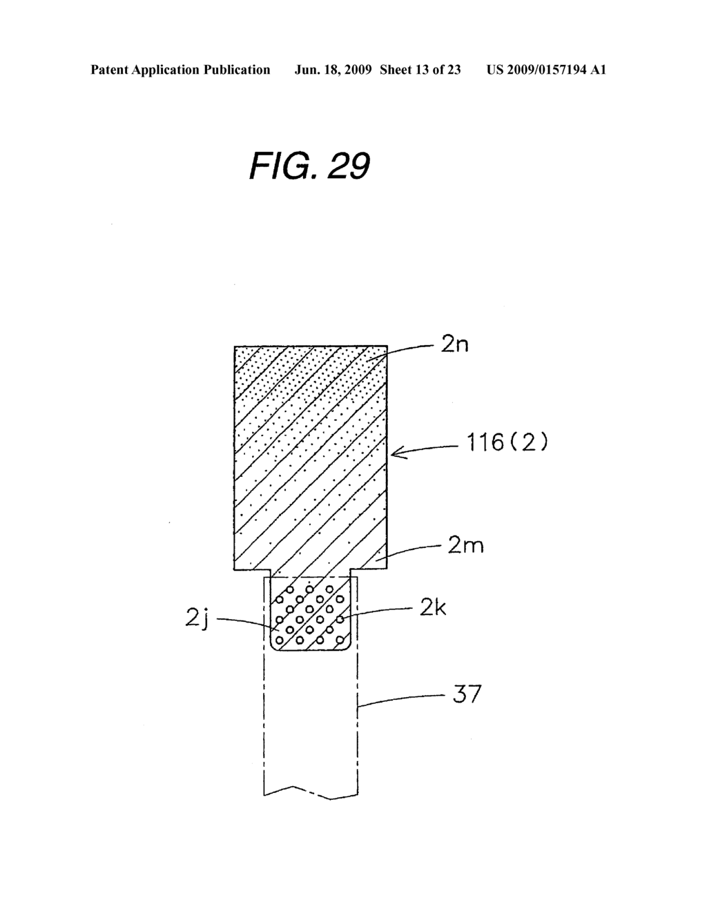 IMPLANT COMPOSITE MATERIAL - diagram, schematic, and image 14