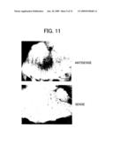 DNA ENCODING POLYPEPTIDE CAPABLE OF MODULATING MUSCLE-SPECIFIC TYROSINE KINASE ACTIVITY diagram and image