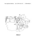 PROCESS AND MACHINE FOR AUTOMATED MANUFACTURE OF GASTRO-RETENTIVE CAPSULES diagram and image