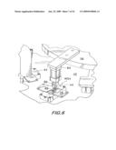 PROCESS AND MACHINE FOR AUTOMATED MANUFACTURE OF GASTRO-RETENTIVE CAPSULES diagram and image